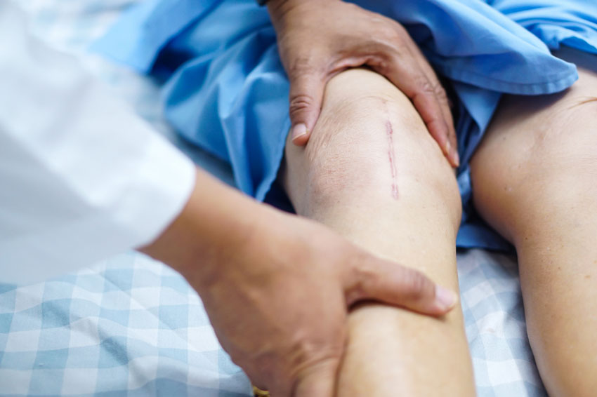 knee replacement surgery recovery